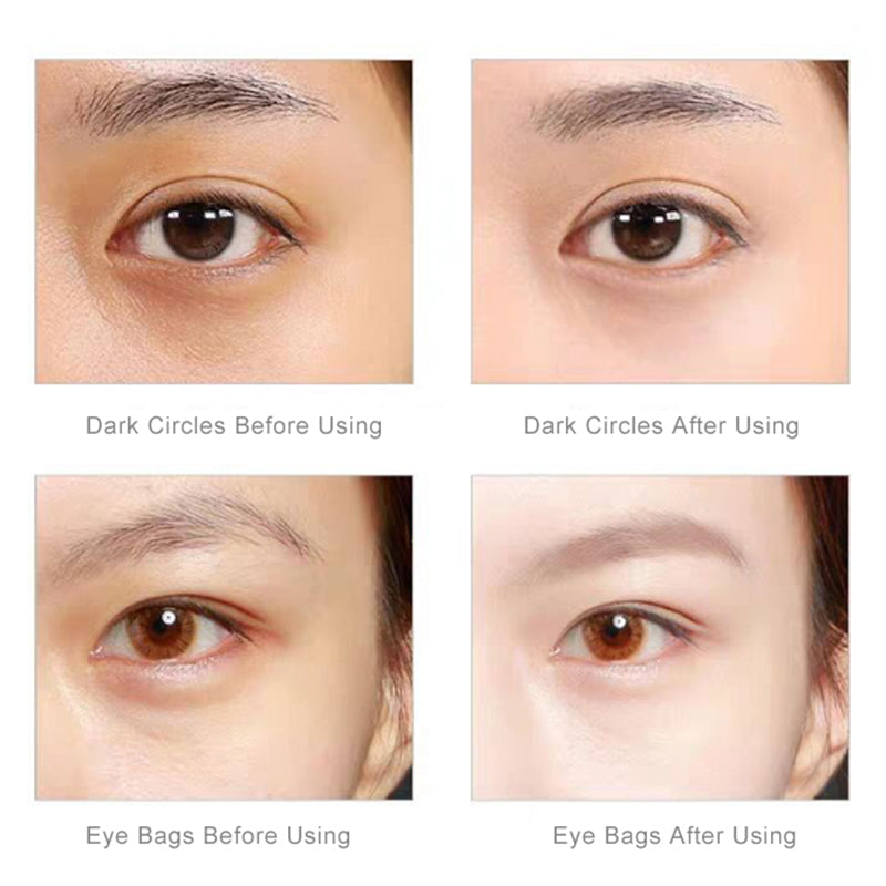 Eye Massager with Anti-Bag Eye Cream