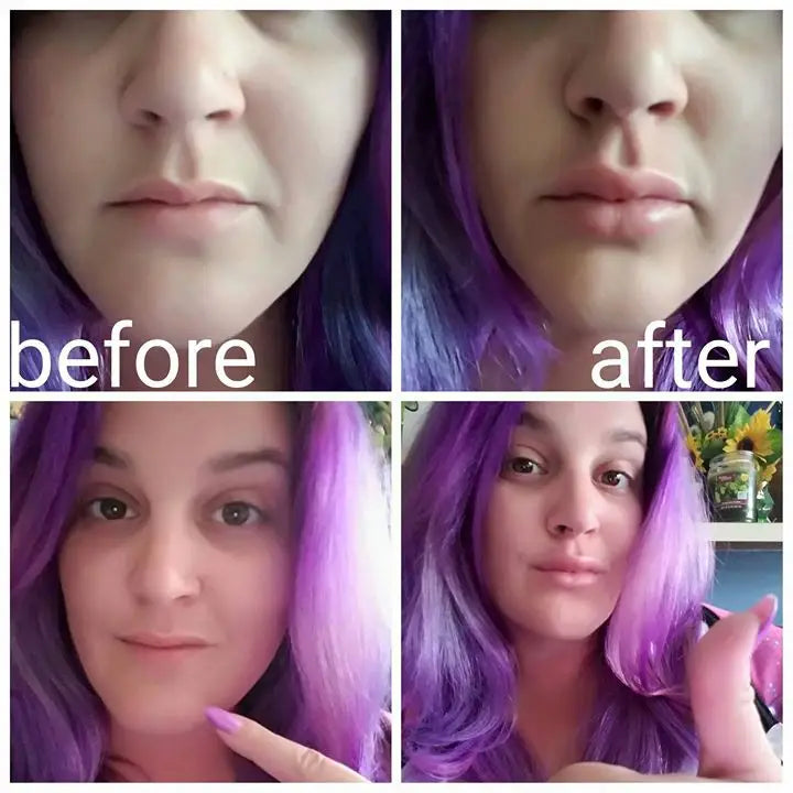 Electric Automatic Lip Plumper — Beauty Enhancement